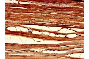 Immunohistochemistry of paraffin-embedded human skeletal muscle tissue using ABIN7147586 at dilution of 1:100 (CLIC2 Antikörper  (AA 53-247))