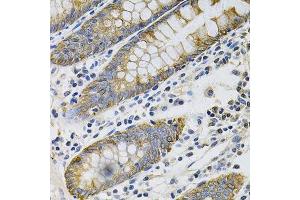 Immunohistochemistry (Paraffin-embedded Sections) (IHC (p)) image for anti-Keratin 20 (KRT20) (AA 245-424) antibody (ABIN3020782)