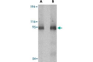 Western blot analysis of CD180 in human spleen tissue lysate with CD180 polyclonal antibody  at (A) 0. (CD180 Antikörper  (C-Term))