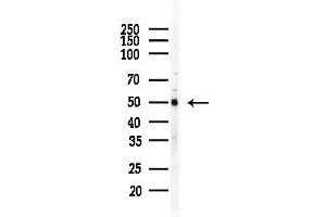 anti-Interferon-Induced Protein with Tetratricopeptide Repeats 1B (IFIT1B) (N-Term) antibody