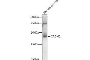 Western blot analysis of extracts of Human plasma, using C antibody (ABIN3022654, ABIN3022655, ABIN3022656 and ABIN6219028) at 1:1000 dilution. (CADM1 Antikörper  (AA 45-344))