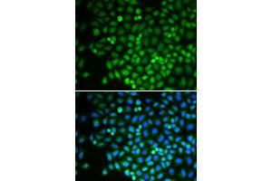 Immunofluorescence analysis of U2OS cell using POLR2D antibody. (POLR2D Antikörper)