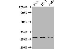 Western Blot Positive WB detected in: Hela whole cell lysate, PC-3 whole cell lysate, A549 whole cell lysate All lanes: RAB23 antibody at 1:2000 Secondary Goat polyclonal to rabbit IgG at 1/50000 dilution Predicted band size: 27 kDa Observed band size: 27 kDa (RAB23 Antikörper  (AA 18-234))