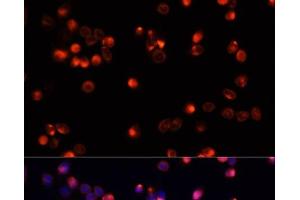 Immunofluorescence analysis of HeLa cells using AKT2 Polyclonal Antibody at dilution of 1:100. (AKT2 Antikörper)