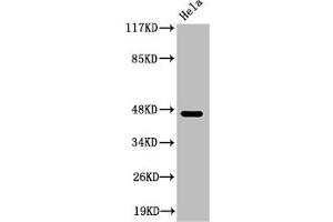 Western Blot analysis of HeLa cells using Cleaved-Plasma Kallikrein HC (R390) Polyclonal Antibody (KLKB1 Antikörper  (Cleaved-Arg390))