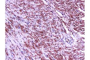 Formalin-fixed and paraffin embedded mouse heart tissue labeled Anti-Connexin-45 Polyclonal Antibody, Unconjugated (ABIN671466) at 1:200, followed by conjugation to the secondary antibody and DAB staining