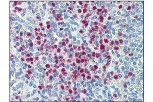 Immunohistochemistry (IHC) image for anti-Myeloid-Associated Differentiation Marker (MYADM) antibody (ABIN953555)