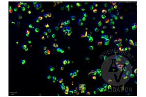 Immunofluorescence of SARS-CoV-2 infection in FFPE cell pellets from in vitro cultured human lung cells infected with SARS-CoV-2.