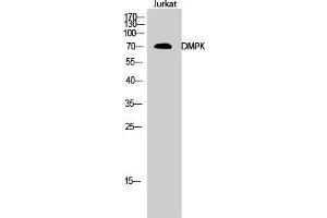 Western Blot (WB) analysis of Jurkat cells using DMPK Polyclonal Antibody. (DMPK Antikörper  (N-Term))