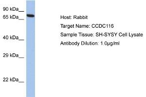Host: Rabbit Target Name: CCDC116 Sample Tissue: Human SH-SYSY Whole Cell  Antibody Dilution: 1ug/ml (CCDC116 Antikörper  (C-Term))
