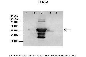Western Blotting (WB) image for anti-Epilepsy, Progressive Myoclonus Type 2A, Lafora Disease (Laforin) (EPM2A) (N-Term) antibody (ABIN2789472)