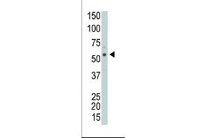 Western Blotting (WB) image for anti-Protein Interacting With Protein Kinase C, alpha 1 (PICK1) (AA 1-30), (N-Term) antibody (ABIN391108)
