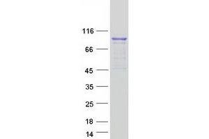 Validation with Western Blot