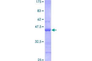 Image no. 1 for Bone Marrow Stromal Cell Antigen 2 (BST2) (AA 40-180) protein (GST tag) (ABIN1346914)