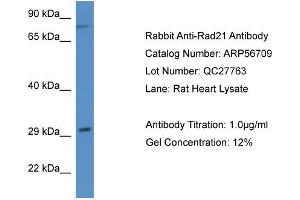 Western Blotting (WB) image for anti-RAD21 Homolog (RAD21) (N-Term) antibody (ABIN2786857) (RAD21 Antikörper  (N-Term))