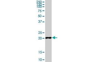 Image no. 1 for anti-Cytochrome B-245, alpha Polypeptide (CYBA) antibody (ABIN1042638) (CYBA Antikörper)