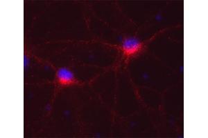 Indirect immunofluorescence on cultured rat neurons (dilution 1 : 250; red).