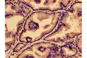 Immunohistochemistry of paraffin-embedded human prostate tissue using ABIN7164874 at dilution of 1:100