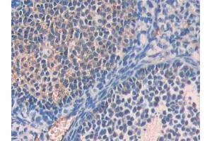 DAB staining on IHC-P; Samples: Mouse Ovary Tissue (Fetuin A Antikörper  (AA 19-250))