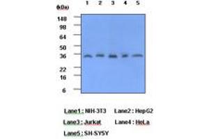 Image no. 1 for anti-C-Reactive Protein (CRP) (AA 19-224) antibody (ABIN377183) (CRP Antikörper  (AA 19-224))