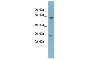 DERL3 antibody used at 1 ug/ml to detect target protein. (Derlin-3 Antikörper  (Middle Region))