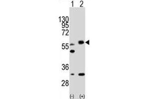 Western Blotting (WB) image for anti-serine/threonine Kinase 11 (STK11) (AA 14-44) antibody (ABIN3032540)