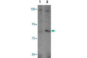 Western blot analysis of APBA2 in human brain tissue lysate with APBA2 polyclonal antibody  at (1) 1 and (2) 2 ug/mL.