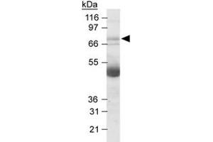 Western blot analysis of NOX4 in human kidney lysates with NOX4 polyclonal antibody at 2. (NADPH Oxidase 4 Antikörper  (AA 100-200))