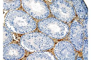 ABIN6262814 and ABIN6273131 at 1/100 staining Mouse testis tissue by IHC-P. (KIFC3 Antikörper  (C-Term))
