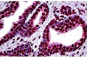 Human Prostate: Formalin-Fixed, Paraffin-Embedded (FFPE) (MEF2A Antikörper  (AA 71-170))