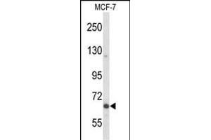Western blot analysis of P2 Antibody  in MCF-7 cell line lysates (35 μg/lane). (MAP2 Antikörper)