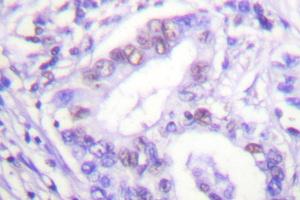 Image no. 1 for anti-Protein Inhibitor of Activated STAT, 4 (PIAS4) antibody (ABIN271954) (PIAS4 Antikörper)