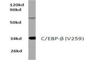 Image no. 1 for anti-CCAAT/enhancer Binding Protein (C/EBP), beta (CEBPB) antibody (ABIN272175) (CEBPB Antikörper)