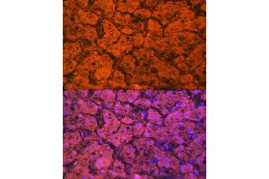 Immunofluorescence analysis of human liver using Hemopexin (HPX) (HPX) Rabbit mAb (ABIN7267611) at dilution of 1:100 (40x lens). (Hemopexin Antikörper)