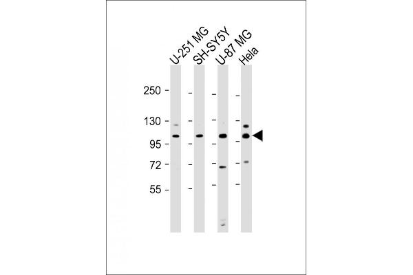 SH3PXD2B Antikörper  (AA 505-539)