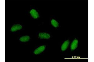 Immunofluorescence of purified MaxPab antibody to PRRX1 on HepG2 cell. (PRRX1 Antikörper  (AA 1-217))