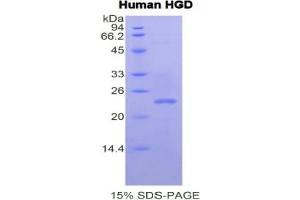SDS-PAGE analysis of Human HGD Protein.