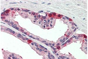 Human Prostate (formalin-fixed, paraffin-embedded) stained with TAOK3 antibody ABIN337220 at 1:5 followed by biotinylated anti-goat IgG secondary antibody ABIN481715, alkaline phosphatase-streptavidin and chromogen. (TAO Kinase 3 Antikörper  (AA 396-411))