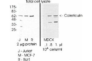 Image no. 1 for anti-Calreticulin (CALR) (C-Term) antibody (ABIN265295) (Calreticulin Antikörper  (C-Term))