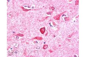 Image no. 1 for anti-PITPNM Family Member 3 (PITPNM3) (C-Term) antibody (ABIN374424) (NIR1 Antikörper  (C-Term))