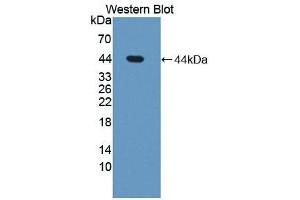 Detection of Recombinant STS, Human using Polyclonal Antibody to Steroid Sulfatase Isozyme S (STS) (STS Antikörper  (AA 235-583))