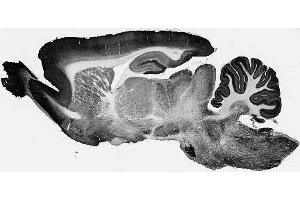Adult rat brain immunohistochemistry.