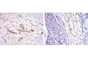 Immunohistochemical analysis of paraffin-embedded brain tissues (left) and esophageal cancer tissues (right) using HSP27 mouse mAb with DAB staining. (HSP27 Antikörper)