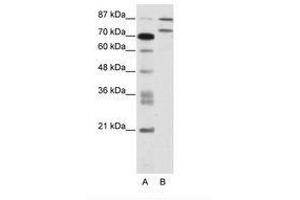 Image no. 1 for anti-Zinc Finger Protein 709 (ZNF709) (AA 61-110) antibody (ABIN202844) (ZNF709 Antikörper  (AA 61-110))