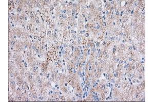 Immunohistochemical staining of paraffin-embedded Human liver tissue using anti-BTK mouse monoclonal antibody. (BTK Antikörper)