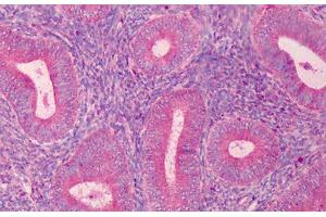 Human Endometrium: Formalin-Fixed, Paraffin-Embedded (FFPE) (PAK2 Antikörper  (C-Term))