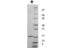SDS-PAGE of Mouse Granulocyte Colony Stimulating Factor Recombinant Protein SDS-PAGE of Mouse Granulocyte Colony Stimulating Factor Recombinant Protein.