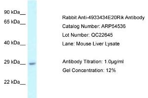 Western Blotting (WB) image for anti-RIKEN CDNA 4933434E20 Gene (4933434E20RIK) (N-Term) antibody (ABIN2774077) (4933434E20Rik Antikörper  (N-Term))