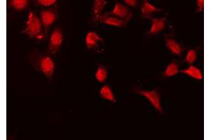 ABIN6267599 staining HeLa by IF/ICC.