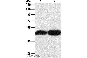Western blot analysis of NIH/3T3 and Lncap cell, using TEKT1 Polyclonal Antibody at dilution of 1:500 (TEKT1 Antikörper)